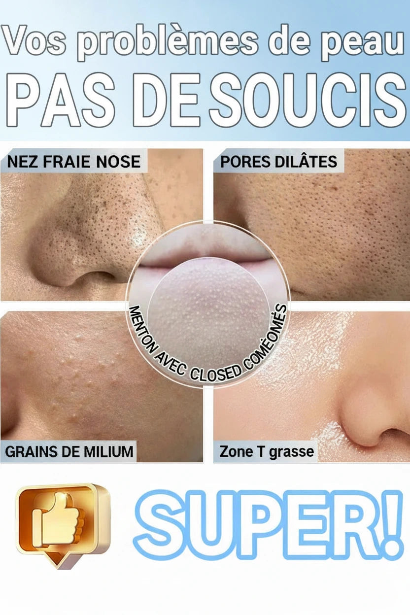 Extracteur de points noirs